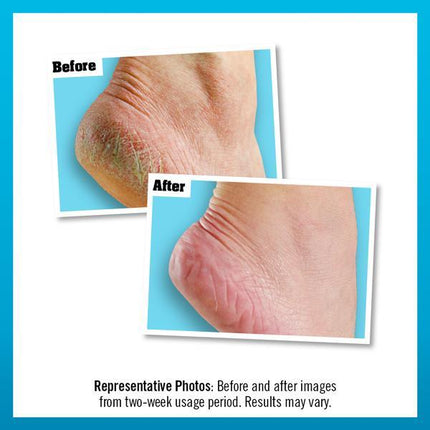O’Keeffe's Healthy Feet Exfoliating Moisturising Foot Cream - 85ml - General Healthcare