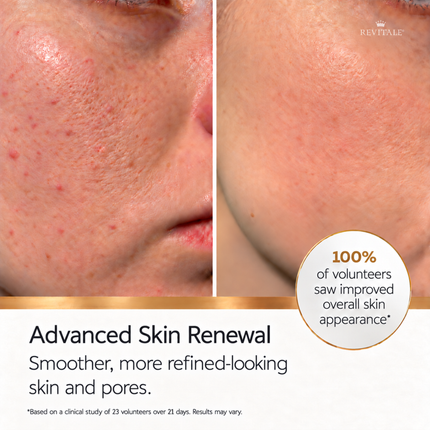 Revitale Advanced Salicylic Acid (BHA) Cream 80g