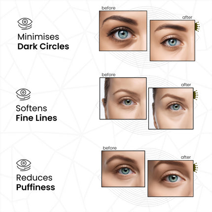 Revitale Pure Under Eye Patches - Nourishes - Renews - Soothes (10 Pairs)