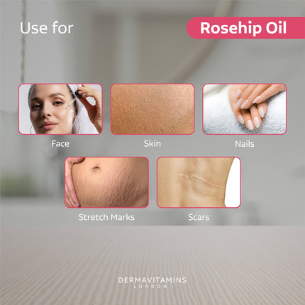 Dermavitamins 100% Organic Cold - Pressed Rose Hip Oil - General Healthcare