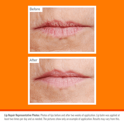 O'Keeffe's SPF15 Lip Balm Repair and Protect - Ski - Sun, 4.2 g - General Healthcare