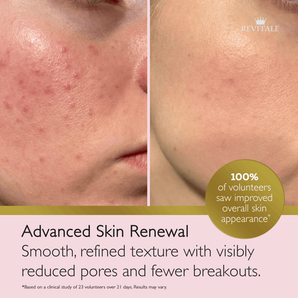 Revitale Advanced Salicylic Acid Cream 80g - General Healthcare