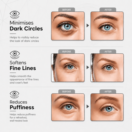 Revitale Pure Vegan Under Eye Patches (30 Pairs) - General Healthcare